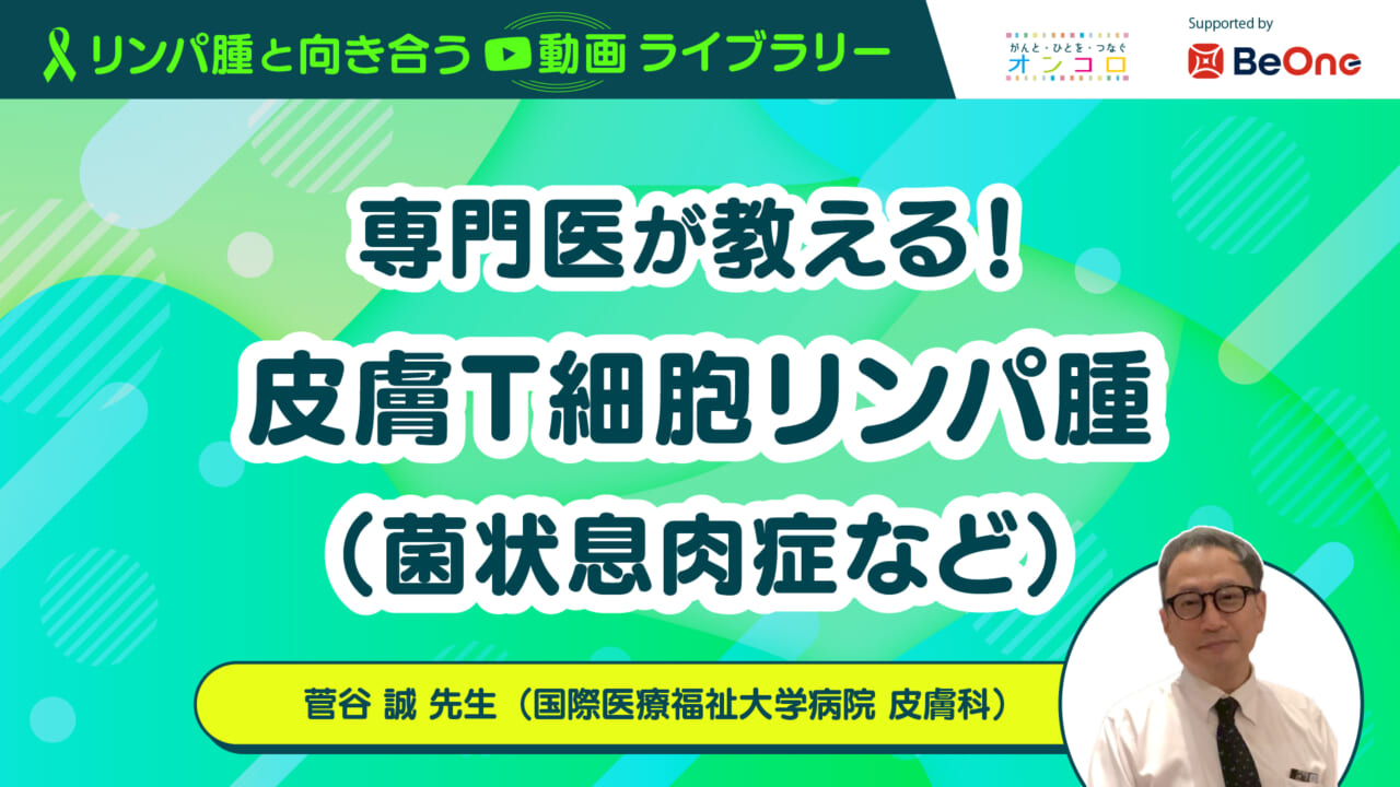 「専門医が教える！皮膚T細胞リンパ腫（菌状息肉症など）」：がん情報サイト「オンコロ」リンパ腫と向き合う動画ライブラリーシリーズ