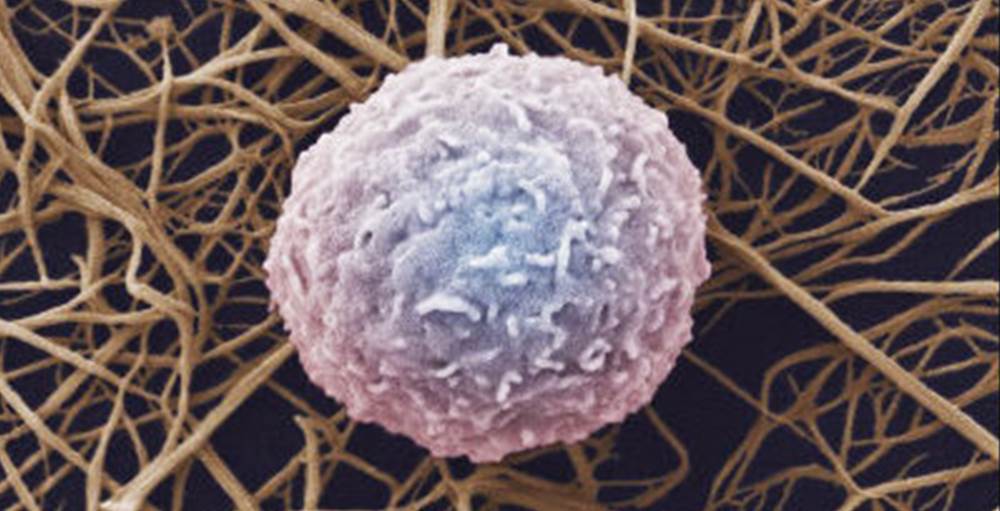 がん細胞を正常細胞が“排除”するメカニズム、京大が解明 新治療法へ