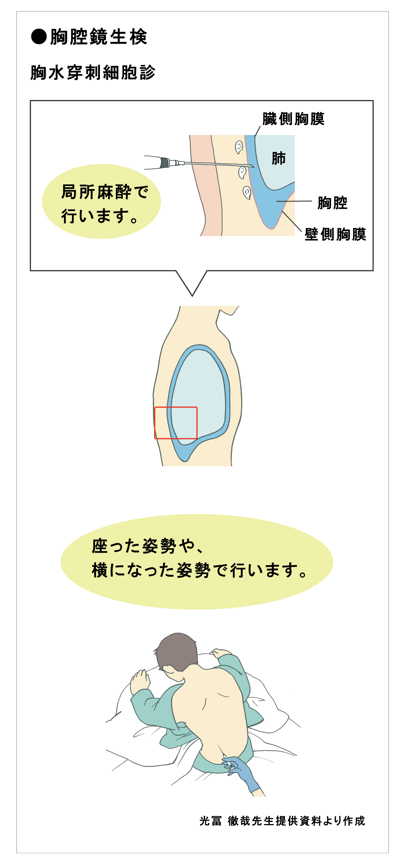 遺伝子 Pd L1の検査方法について がん情報サイト オンコロ