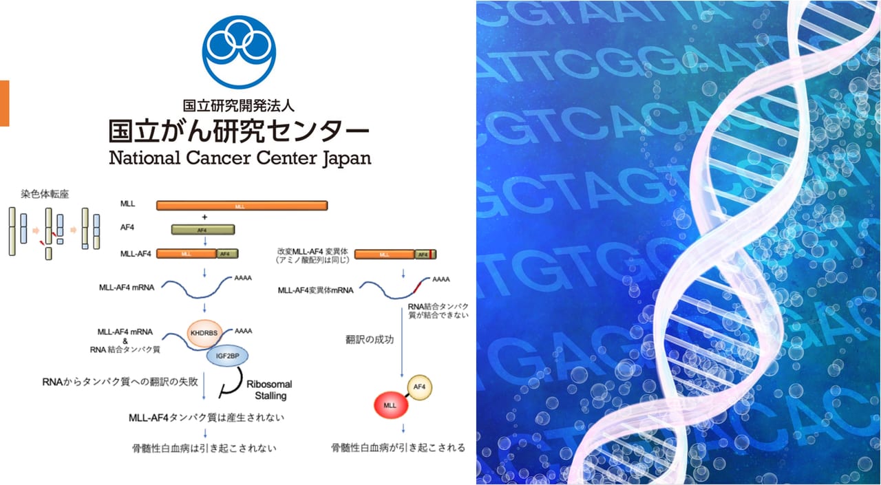 高悪性度の白血病のがん遺伝子発現制御機構を解明、MLL-AF4白血病を