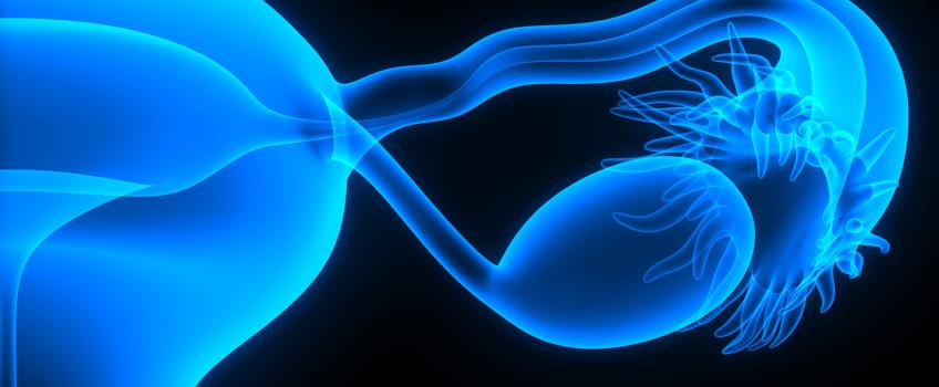 ASCO 2023 – 卵巣がんにおける免疫腫瘍学の位置づけがついに明らかに？